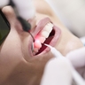 Parodontologie Zahnarztpraxis confident Esslingen