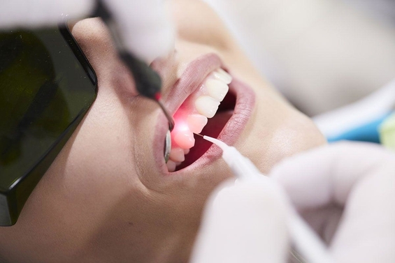 Parodontologie Zahnarztpraxis confident Esslingen